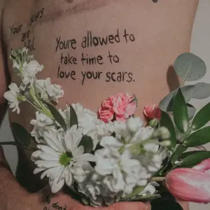 Loving Your Scars