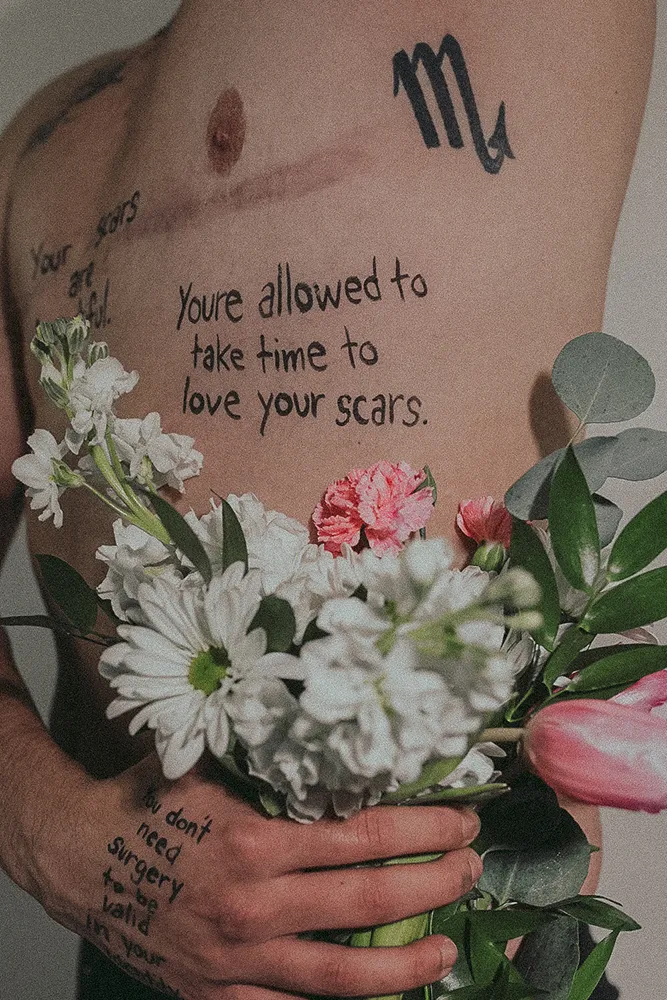 Loving Your Scars